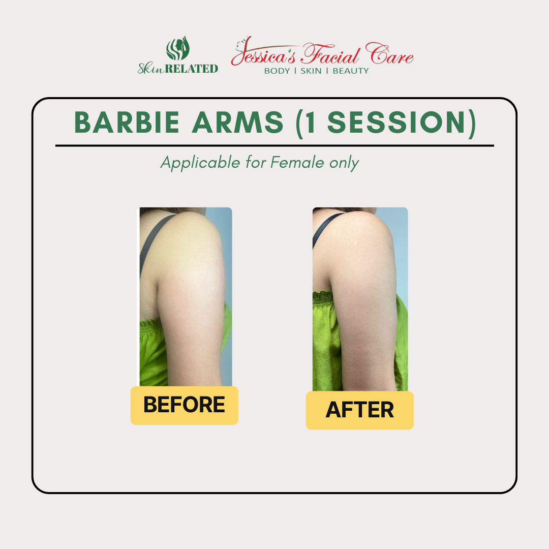 Barbie Arms